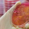 ruker MALDI Biotyper® System